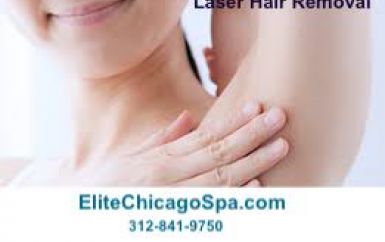 Best Laser Hair Removal Chicago